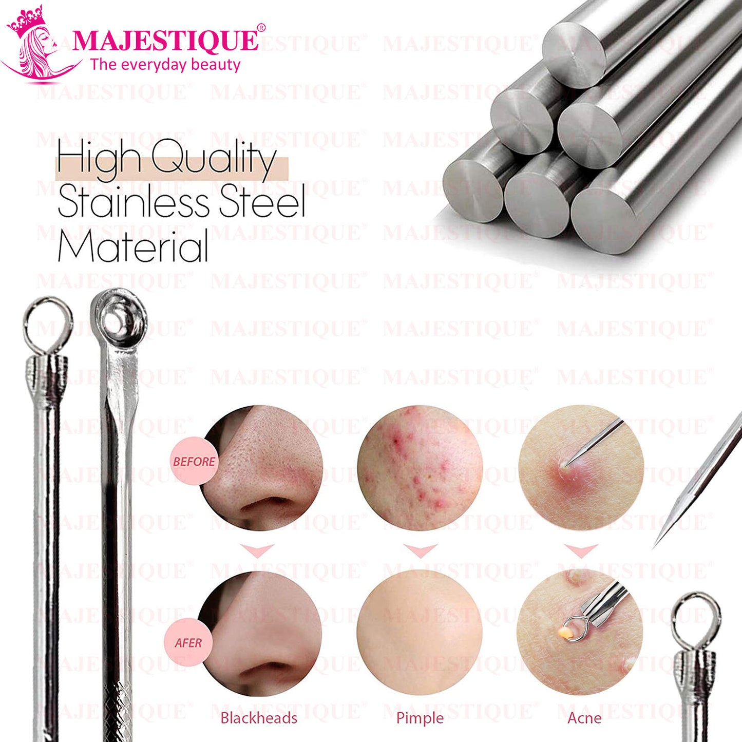 BLACKFHEAD REMOVER (PACK OF 2) CMB523
