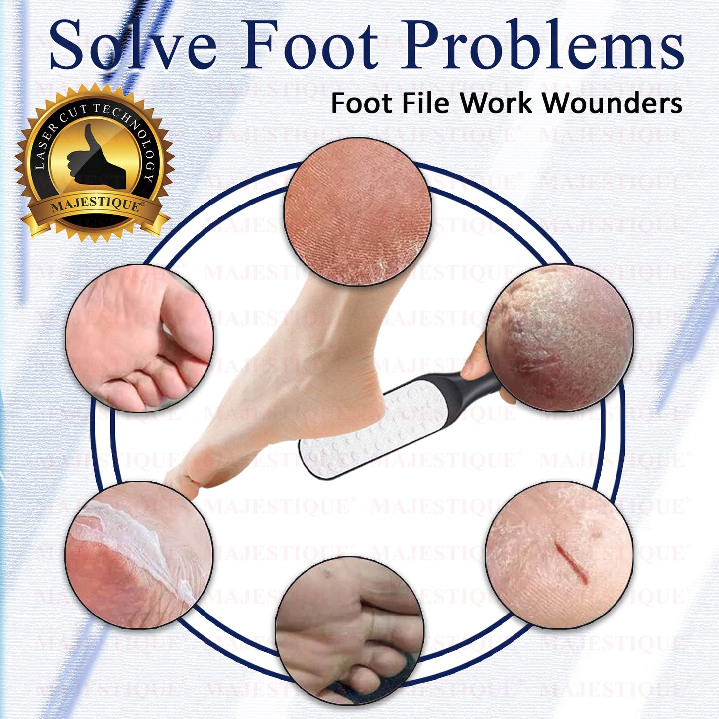 Foot Callus Remover Multicolor FN320